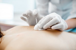 Acupuntor / Acupuntora